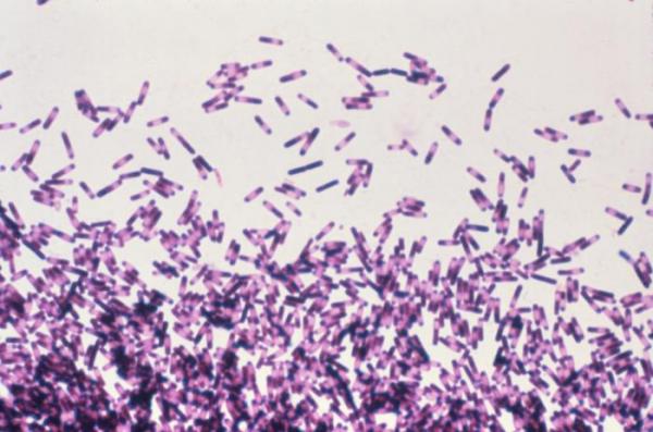 an image of the Clostridium Difficile bacteria in a lab